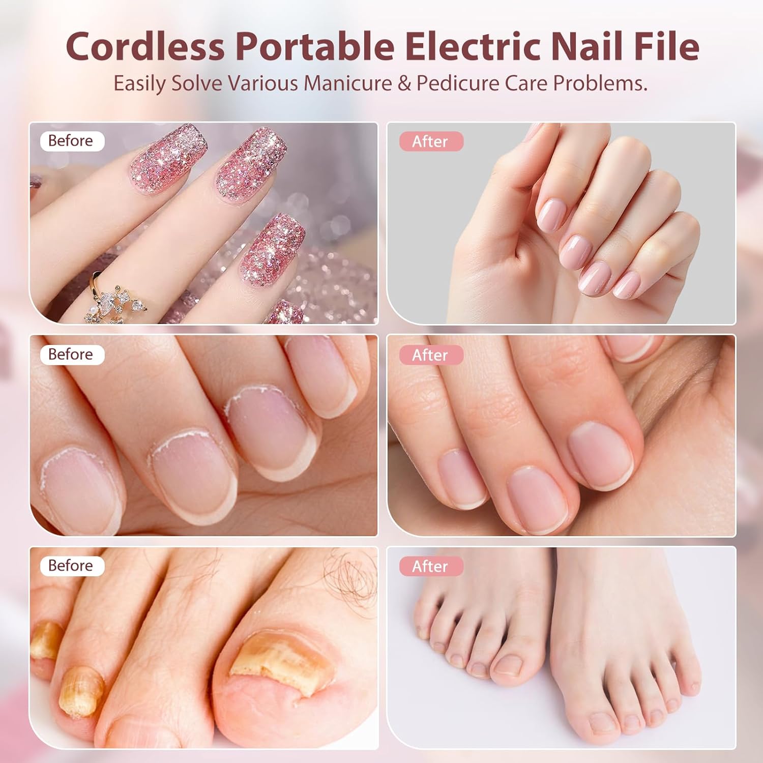 Cordless professional nail drill kit in neutral color with included bits and sanding bands for acrylic and gel nails — view 2