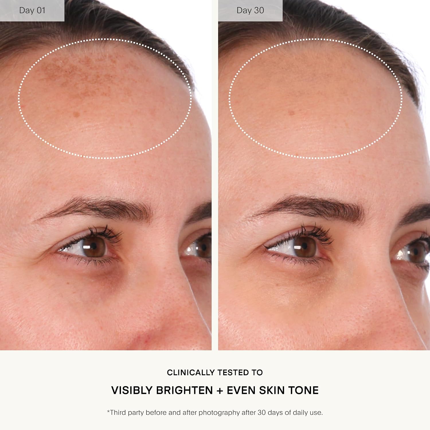 Mandelic acid resurfacing serum bottle with retinol and vitamin C for anti-aging skincare — view 4