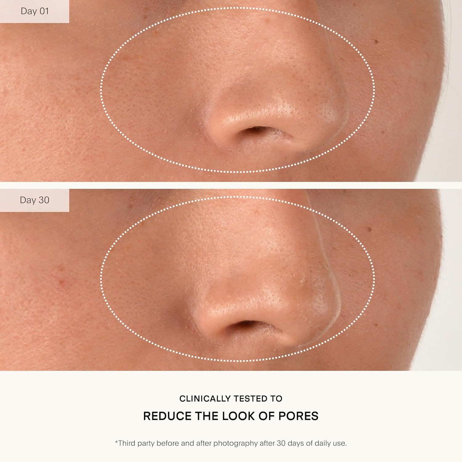 Mandelic acid resurfacing serum bottle with retinol and vitamin C for anti-aging skincare — view 2