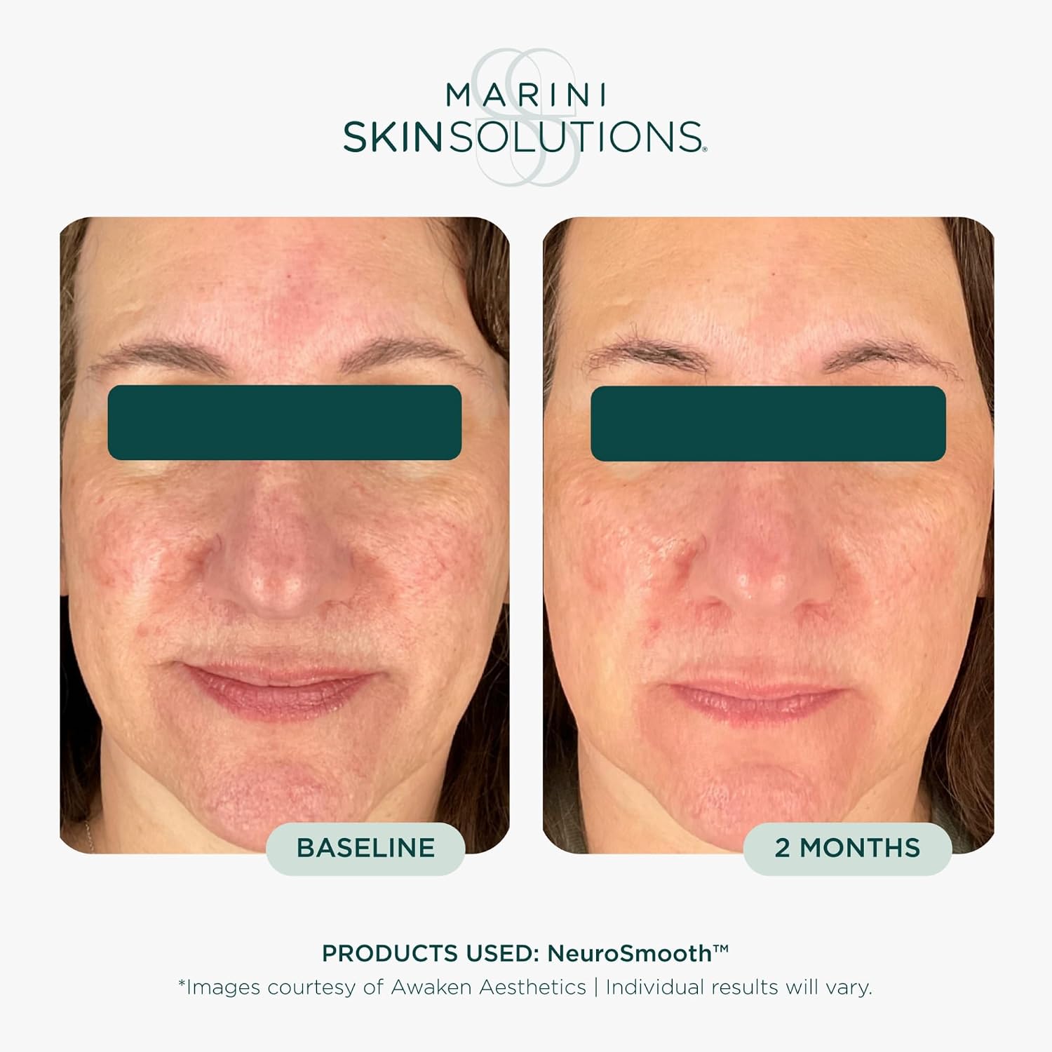 Peptide-powered face serum in neutral apothecary bottle for poreless, glass-smooth skin — back